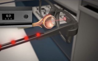 英国团队研发 PRIMA 电子眼，临床试验 84%失明患者恢复阅读能力